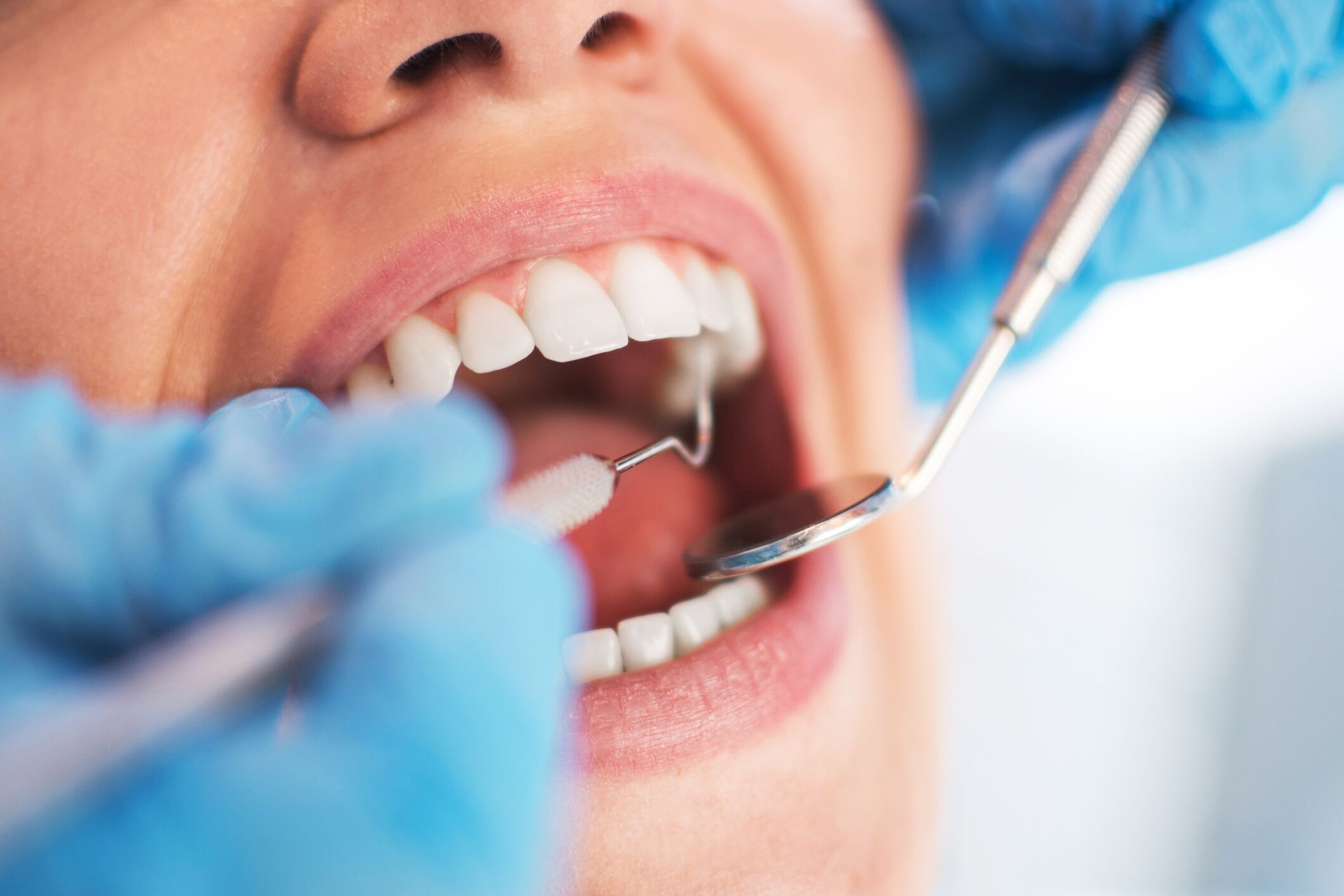 Tips For Preventing Cavities, cavity prevention techniques, dental care advice, oral health tips, cavity control strategies, dental hygiene suggestions, preventive measures for cavities, maintaining oral wellness, cavity defense tactics, ways to prevent tooth decay, dental wellness guidelines, effective cavity prevention, toothfriendly habits, oral hygiene insights, strategies to avoid cavities, tips for a healthy smile, preventing dental cavities, oral care recommendations, techniques for cavityfree teeth, dental health pointers, maintaining strong teeth, cavity avoidance methods, preventing tooth decay, oral hygiene best practices